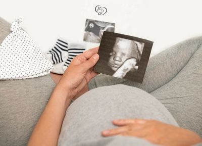 4 Boyutlu Ultrasonografi